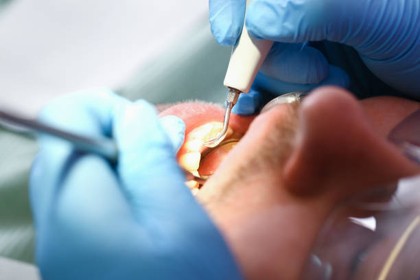 Best Pediatric Emergency Dentist in Somerville, MA